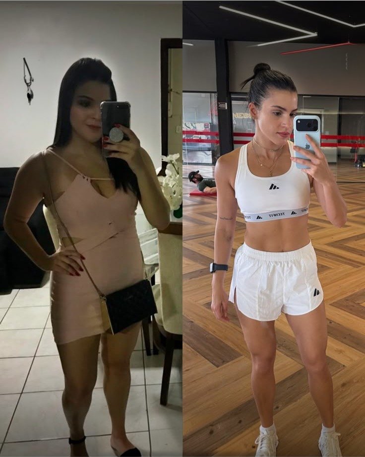 Antes e depois de paciente em acompanhamento de emagrecimento