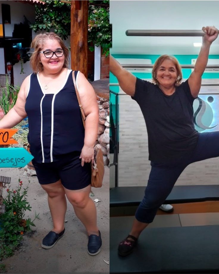 Antes e depois de paciente em acompanhamento clínico